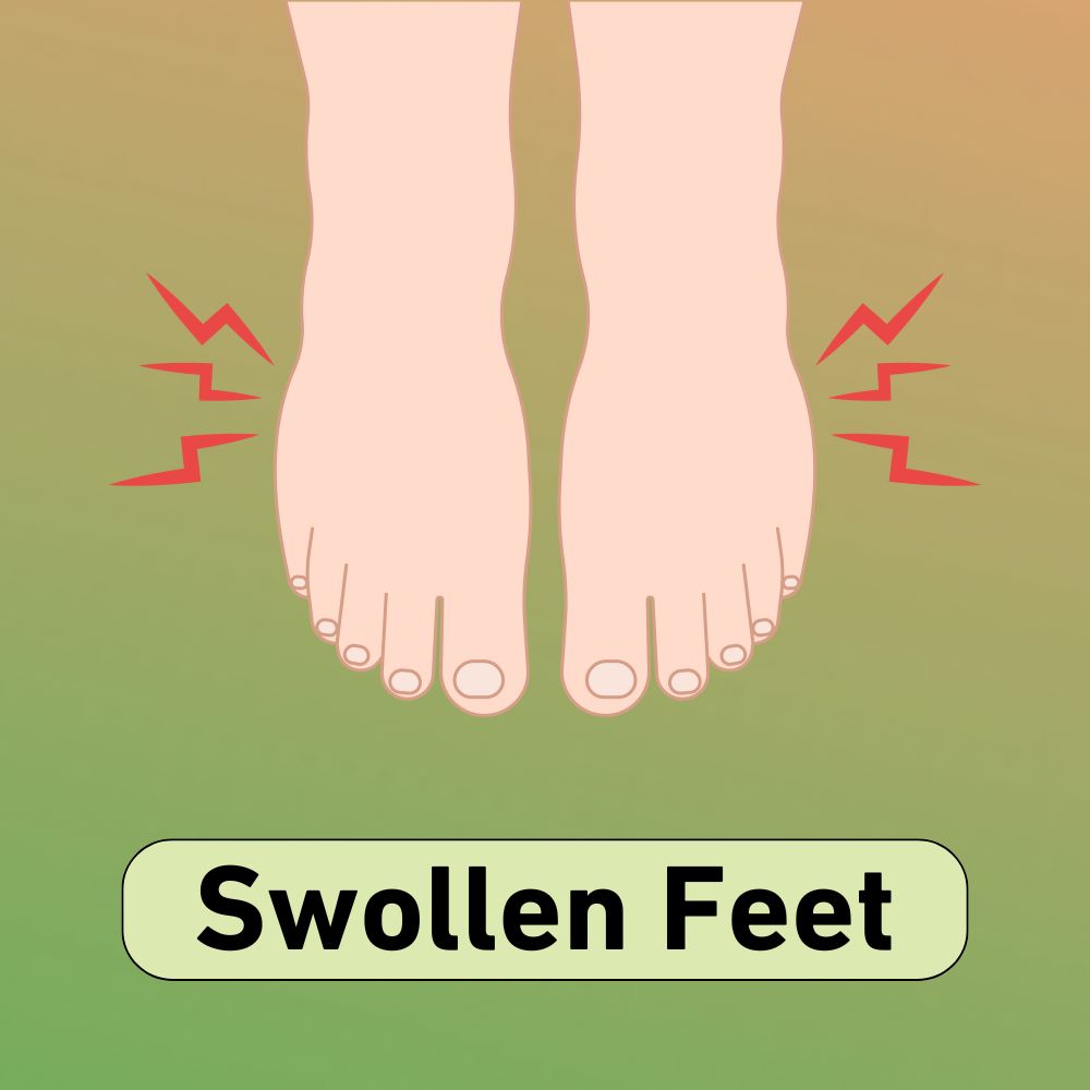 Illustration of swollen feet with red pain lines, highlighting KNSupps Alpha-Flow supplement's potential to alleviate swelling and improve circulation.